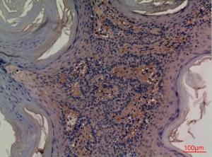 Immunohistochemical analysis of paraffin-embedded human skin using Anti-NT5E Antibody