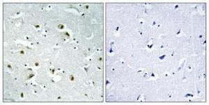 Antibody anti-CEP135 100 µg