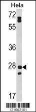 Anti-FAM3B Rabbit Polyclonal Antibody (HRP (Horseradish Peroxidase))