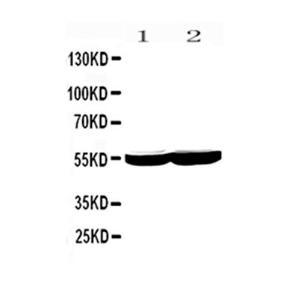 Anti-CYP2E1 Polyclonal Antibody