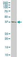 Anti-CDX4 Mouse Monoclonal Antibody [clone: 1E9]