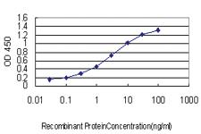 Anti-ZMYND8 Mouse Monoclonal Antibody [clone: 5B12]