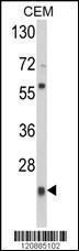 Anti-PRDX1 Rabbit Polyclonal Antibody