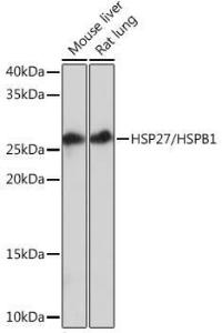 Anti-Hsp27 Rabbit Monoclonal Antibody [Clone: ARC0531]