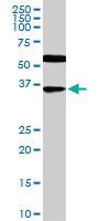 Anti-CDX4 Mouse Monoclonal Antibody [clone: 1E9]