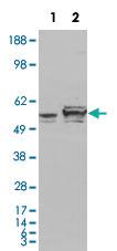 Anti-CALR Mouse Monoclonal Antibody [clone: 1G6A7]