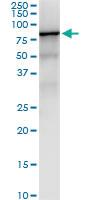 Anti-IGF2BP2 Polyclonal Antibody Pair