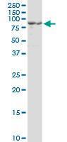 Anti-PCSK1 Mouse Monoclonal Antibody [clone: 3D2]