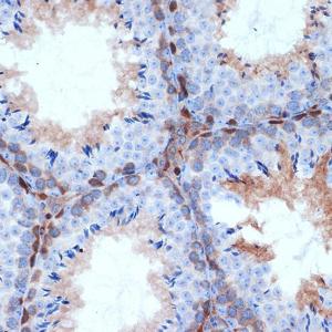 Immunohistochemistry analysis of paraffin-embedded mouse testis using Anti-PKC delta Antibody [ARC1434] (A308143) at a dilution of 1:100 (40x lens). Perform microwave antigen retrieval with 10 mM Tris/EDTA buffer pH 9.0 before commencing with IHC staining protocol.