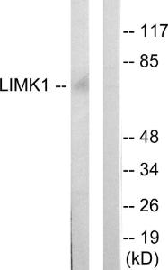 Western blot analysis of lysates from mouse brain using Anti-LIMK1 Antibody. The right hand lane represents a negative control, where the antibody is blocked by the immunising peptide.