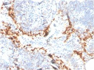 Immunohistochemical analysis of formalin-fixed, paraffin-embedded human lymph node tissue using Anti-TIM3 Antibody [TIM3/4024]