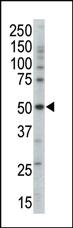 Anti-PRKAG3 Rabbit Polyclonal Antibody