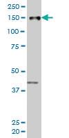 Anti-ZMYND8 Mouse Monoclonal Antibody [clone: 6A12]