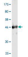 Anti-RAB4A Mouse Monoclonal Antibody [clone: 1E1]