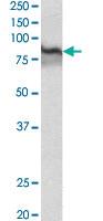 Anti-TGM2 Goat Polyclonal Antibody