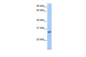 Anti-GSTM3 Rabbit Polyclonal Antibody