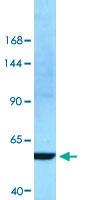 Anti-BHMT Rabbit Polyclonal Antibody