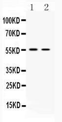 Anti-SLC18A3 Rabbit Polyclonal Antibody