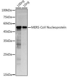 Western blot analysis of extracts of MERS-CoV Nucleoprotein, using Anti-MERS-CoV Nucleoprotein Antibody (A307042) at 1:1,000 dilution. The secondary antibody was Goat Anti-Rabbit IgG H&L Antibody (HRP) at 1:10,000 dilution.