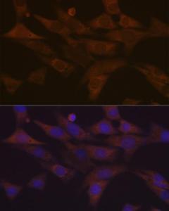 Immunofluorescence analysis of NIH-3T3 cells using Anti-PKC delta Antibody [ARC1434] (A308143) at a dilution of 1:100 (40x lens). DAPI was used to stain the cell nuclei (blue).