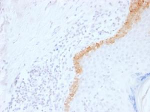 Immunohistochemical analysis of formalin-fixed, paraffin-embedded human skin using Anti-Cytokeratin 15 Antibody [LHK15]