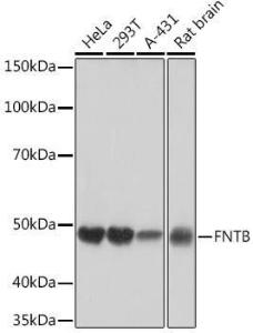 Western blot analysis of extracts of various cell lines, using Anti-FNTB Antibody [ARC1923] (A307043) at 1:1,000 dilution