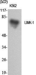 Western blot analysis of various cells using Anti-LIMK1 Antibody