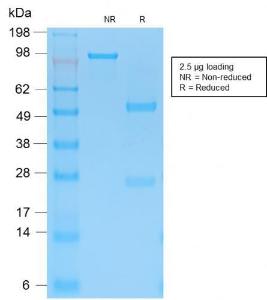 SDS-PAGE analysis of Anti-Cytokeratin 15 Antibody [KRT15/2103R] under non-reduced and reduced conditions; showing intact IgG and intact heavy and light chains, respectively. SDS-PAGE analysis confirms the integrity and purity of the Antibody