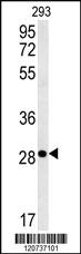 Anti-EPCAM Rabbit Polyclonal Antibody