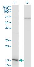 Anti-NFATC2IP Mouse Monoclonal Antibody [clone: 3E9-B7]