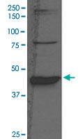 Anti-BHMT Rabbit Polyclonal Antibody