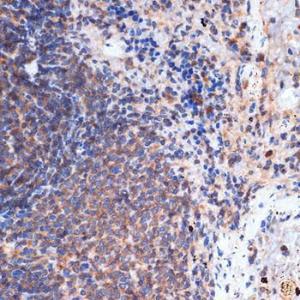 Immunohistochemistry analysis of paraffin-embedded rat spleen using Anti-FNTB Antibody [ARC1923] (A307043) at a dilution of 1:100 (40X lens). Perform microwave antigen retrieval with 10 mM Tris/EDTA buffer pH 9.0 before commencing with IHC staining protocol