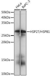 Anti-Hsp27 Rabbit Monoclonal Antibody [Clone: ARC0531]