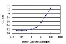 Anti-CAMK2B Antibody Pair