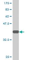 Anti-RNF2 Mouse Monoclonal Antibody [clone: 4A9]