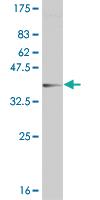 Anti-CRYGC Mouse Monoclonal Antibody [clone: 7C4]