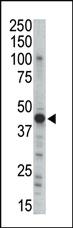 Anti-PKA 2 beta (PRKAR2B) Rabbit Polyclonal Antibody