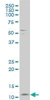 Anti-FXYD3 Mouse Polyclonal Antibody