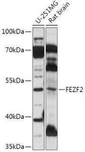 Western blot analysis of extracts of various cell lines, using Anti-ZNF312 / FEZF2 Antibody (A307045) at 1:1,000 dilution. The secondary antibody was Goat Anti-Rabbit IgG H&L Antibody (HRP) at 1:10,000 dilution.