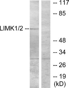 Western blot analysis of lysates from NIH/3T3 cells, treated with UV using Anti-LIMK1 Antibody. The right hand lane represents a negative control, where the antibody is blocked by the immunising peptide.