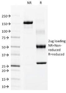 SDS-PAGE analysis of Anti-Cytokeratin 15 Antibody [LHK15] under non-reduced and reduced conditions; showing intact IgG and intact heavy and light chains, respectively SDS-PAGE analysis confirms the integrity and purity of the antibody