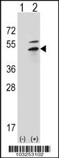 Anti-PKA 2 beta (PRKAR2B) Rabbit Polyclonal Antibody