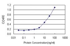 Anti-CAMK2B Polyclonal Antibody Pair