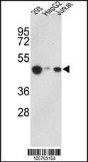 Anti-HAT1 Rabbit Polyclonal Antibody (APC (Allophycocyanin))