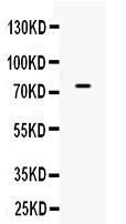 Anti-ACSL3 Rabbit Polyclonal Antibody