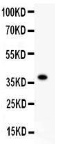 Anti-FGFR4 Polyclonal Antibody