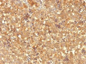 Immunohistochemical analysis of formalin-fixed, paraffin-embedded human fetal liver using Anti-alpha Fetoprotein Antibody [MBS-12]