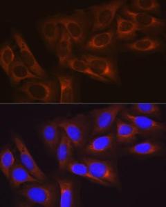 Anti-Hsp27 Rabbit Monoclonal Antibody [Clone: ARC0531]