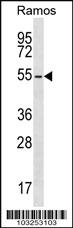 Anti-PKA 2 beta (PRKAR2B) Rabbit Polyclonal Antibody