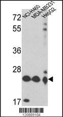 Anti-PRDX3 Rabbit Polyclonal Antibody